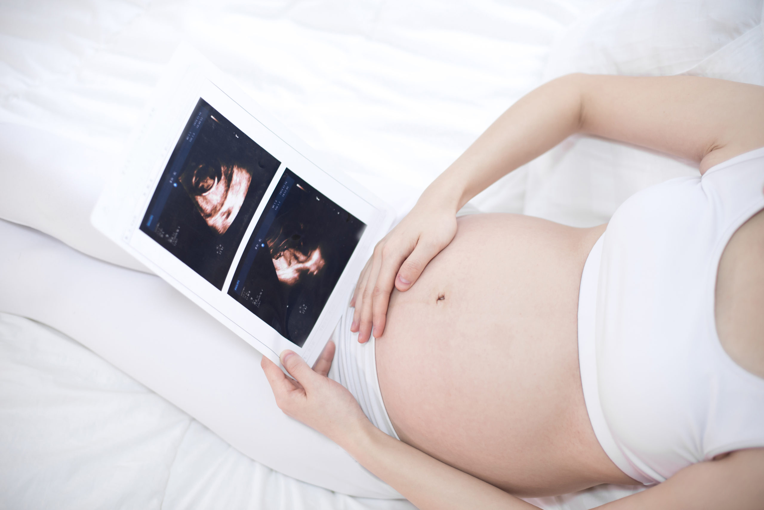 Control prenatal mensual, la clave para detectar a tiempo la preeclampsia