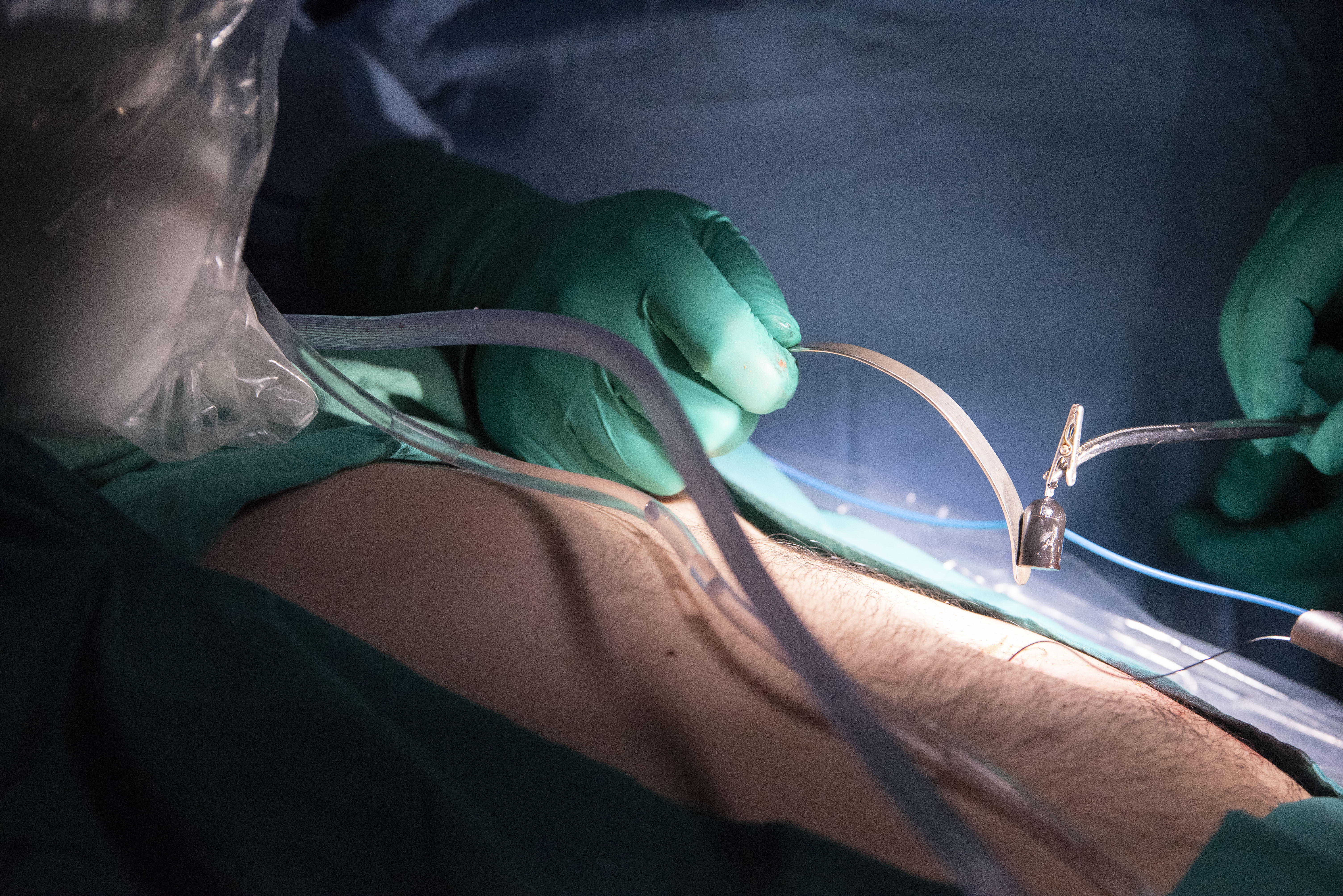 Técnica quirúrgica menos invasiva